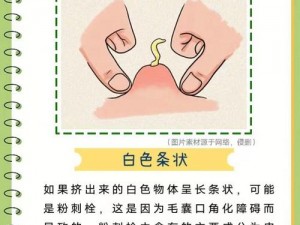 豆豆为什么能挤出白液体、如果豆豆身上长了痘痘，为什么能挤出白色液体？