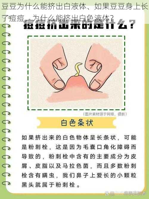 豆豆为什么能挤出白液体、如果豆豆身上长了痘痘，为什么能挤出白色液体？