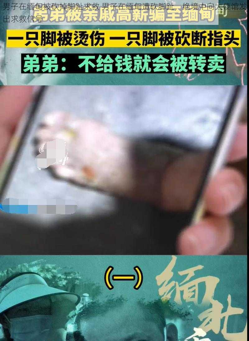 男子在缅甸被砍掉脚趾求救 男子在缅甸遭砍脚趾，绝境中向大使馆发出求救信号