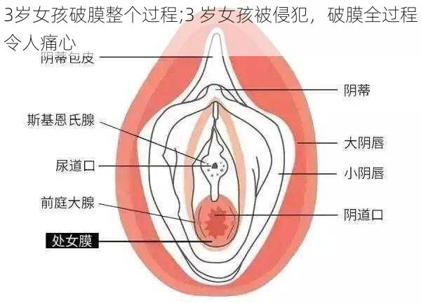 3岁女孩破膜整个过程;3 岁女孩被侵犯，破膜全过程令人痛心